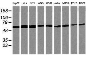 Image no. 4 for anti-Tripartite Motif Containing 38 (TRIM38) (AA 1-265) antibody (ABIN1490680) (TRIM38 anticorps  (AA 1-265))
