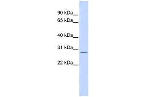 ECHS1 antibody used at 1 ug/ml to detect target protein.