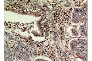 Immunohistochemistry (IHC) analysis of paraffin-embedded Human Liver, antibody was diluted at 1:100. (Thrombopoietin anticorps  (Internal Region))