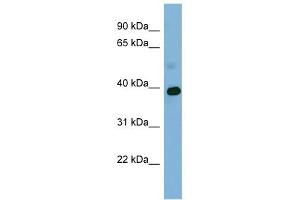 GAPDH antibody used at 1 ug/ml to detect target protein. (GAPDH anticorps  (Middle Region))