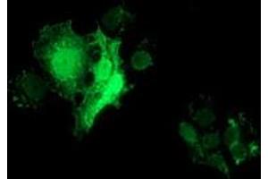 Anti-FHL1 mouse monoclonal antibody (ABIN2453042) immunofluorescent staining of COS7 cells transiently transfected by pCMV6-ENTRY FHL1 (RC203478).