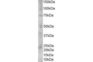 Image no. 1 for anti-Premelanosome Protein (PMEL) (C-Term) antibody (ABIN374704) (Melanoma gp100 anticorps  (C-Term))