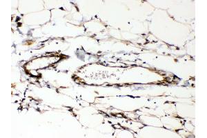IHC analysis of Cyclophilin B using anti-Cyclophilin B antibody .