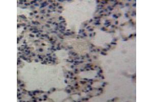 Used in DAB staining on fromalin fixed paraffin-embedded lung tissue