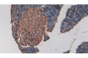 Detection of HIF2a in Mouse Pancreas Tissue using Polyclonal Antibody to Hypoxia Inducible Factor 2 Alpha (HIF2a)