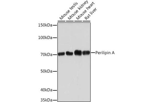 PLIN1 anticorps
