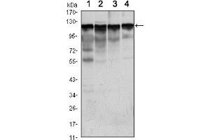 Western blot analysis using HK1 mouse mAb against Jurkat (1), Hela (2), HepG2 (3) and NIH/3T3 (4) cell lysate. (Hexokinase 1 anticorps)