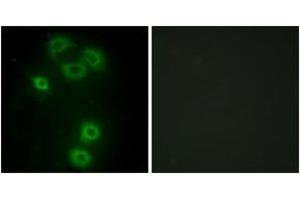 Immunofluorescence analysis of A549 cells, using BMX Antibody.