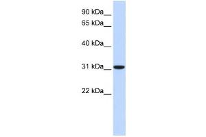 Western Blotting (WB) image for anti-Carbonic Anhydrase VIII (CA8) antibody (ABIN2458629)