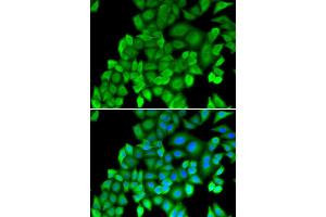 Immunofluorescence (IF) image for anti-Proteasome (Prosome, Macropain) Subunit, beta Type, 4 (PSMB4) antibody (ABIN1876898) (PSMB4 anticorps)