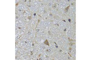 Immunohistochemistry of paraffin-embedded mouse brain using CHN1 antibody (ABIN5974737) at dilution of 1/100 (40x lens). (CHN1 anticorps)