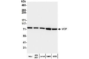 Western Blotting (WB) image for anti-Valosin Containing Protein (VCP) (C-Term) antibody (ABIN7452151) (VCP anticorps  (C-Term))