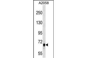 Western blot analysis in A2058 cell line lysates (35ug/lane).