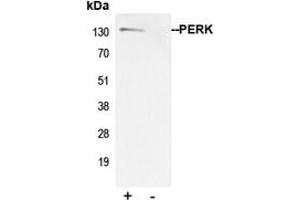 Immunoprecipitation of PERK from 0.