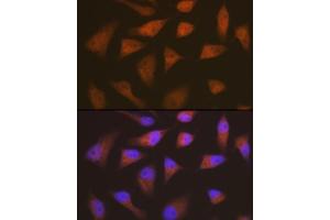 Immunofluorescence analysis of HeLa cells using CDKN2C/p18-INK4C Rabbit mAb  at dilution of 1:100 (40x lens).