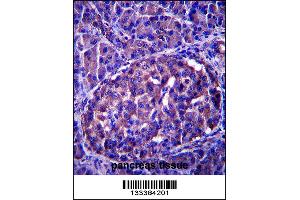 LRRN4 Antibody immunohistochemistry analysis in formalin fixed and paraffin embedded human pancreas tissue followed by peroxidase conjugation of the secondary antibody and DAB staining. (LRRN4 anticorps  (C-Term))