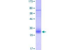 Image no. 1 for Tumor Necrosis Factor Receptor Superfamily, Member 10b (TNFRSF10B) (AA 56-210) protein (His-DYKDDDDK-Strep II Tag) (ABIN1323142)