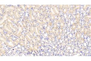 Detection of GLS2 in Mouse Kidney Tissue using Polyclonal Antibody to Glutaminase 2 (GLS2)