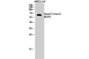 Western Blotting (WB) image for anti-Cortactin (CTTN) (acLys235) antibody (ABIN3178875) (Cortactin anticorps  (acLys235))