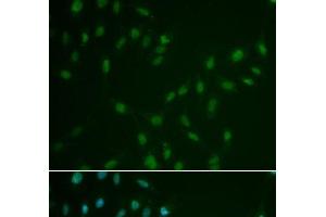 Immunofluorescence analysis of A549 cells using HSF2 Polyclonal Antibody (HSF2 anticorps)
