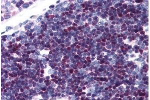 Human Thymus (formalin-fixed, paraffin-embedded) stained with SATB1 antibody ABIN343896 at 5 ug/ml followed by biotinylated goat anti-rabbit IgG secondary antibody ABIN481713, alkaline phosphatase-streptavidin and chromogen. (SATB1 anticorps  (C-Term))