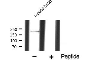 Western blot analysis of MYLK expression in mouse brain (MYLK anticorps  (C-Term))