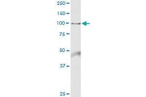Immunoprecipitation of HELLS transfected lysate using anti-HELLS MaxPab rabbit polyclonal antibody and Protein A Magnetic Bead , and immunoblotted with HELLS purified MaxPab mouse polyclonal antibody (B01P) .