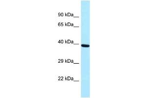 Western Blotting (WB) image for anti-PRP18 Pre-mRNA Processing Factor 18 (PRPF18) (Middle Region) antibody (ABIN2774355) (PRPF18 anticorps  (Middle Region))