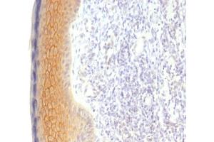Formalin-fixed, paraffin-embedded human Skin stained with Catenin, gamma Monoclonal Antibody (CTNG/1483) (JUP anticorps)