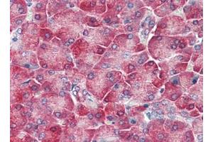 Human Pancreas (formalin-fixed, paraffin-embedded) stained with TLR3at 5 µg/ml followed by biotinylated goat anti-rabbit IgG secondary antibody, alkaline phosphatase-streptavidin and chromogen.