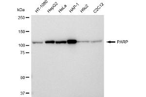Western blotting analysis using PARP antibody (ABIN7799866).