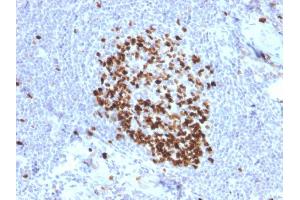 Formalin-fixed, paraffin-embedded human Tonsil stained with Ki67 Mouse Monoclonal Antibody (MKI67/2466). (Ki-67 anticorps  (AA 2293-2478))