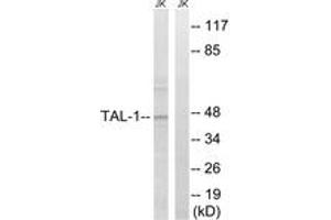 Western blot analysis of extracts from Jurkat cells, treated with PMA 125ng/ml 30', using TAL-1 (Ab-122) Antibody. (TAL1 anticorps  (AA 96-145))