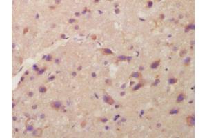 Formalin-fixed and paraffin embedded rat brain labeled with Anti-ITM2A Polyclonal Antibody, Unconjugated  at 1:200 followed by conjugation to the secondary antibody and DAB staining (ITM2A anticorps  (AA 73-123))