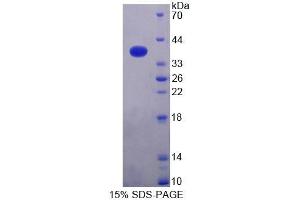 SDS-PAGE analysis of Human NAPa Protein. (NAPA Protéine)