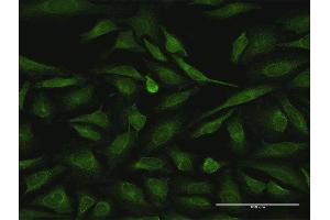 Immunofluorescence of purified MaxPab antibody to RIPK2 on HeLa cell. (RIPK2 anticorps  (AA 1-540))