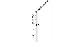 Western blot analysis of lysate from human skeletal muscle tissue lysate,using SCN4B Antibody.