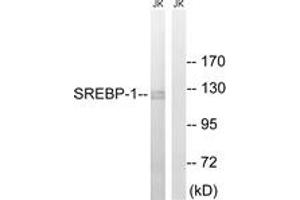 Western blot analysis of extracts from Jurkat cells, treated with TNF 20ng/ml 30', using SREBP-1 (Ab-439) Antibody. (SREBF1 anticorps  (AA 405-454))