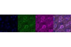 Immunohistochemistry (IHC) image for anti-Calcium/calmodulin-Dependent Protein Kinase II alpha (CAMK2A) antibody (ABIN7456112) (CAMK2A anticorps)