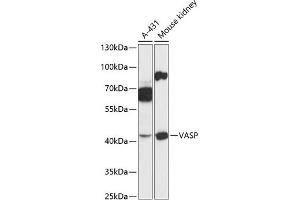 Western blot analysis of extracts of various cell lines, using VASP antibody (ABIN6134453, ABIN6150064, ABIN6150065 and ABIN6218508) at 1:3000 dilution. (VASP anticorps  (AA 1-100))