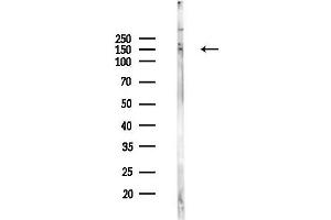 anti-Tight Junction Protein 2 (Zona Occludens 2) (TJP2) (pTyr1118) antibody