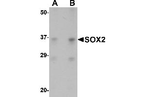 Western Blotting (WB) image for anti-SRY (Sex Determining Region Y)-Box 2 (SOX2) (N-Term) antibody (ABIN1031582) (SOX2 anticorps  (N-Term))