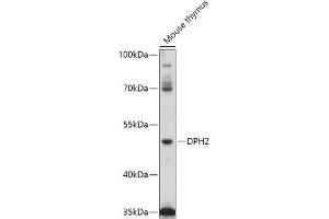 Western blot analysis of extracts of Mouse thymus, using DPH2 antibody (ABIN7266787) at 1:1000 dilution. (DPH2 anticorps  (AA 120-330))