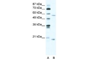 WB Suggested Anti-ZNF18 Antibody Titration:  5ug/ml  Positive Control:  HepG2 cell lysate (ZNF18 anticorps  (N-Term))