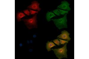 ABIN6261249 and ABIN6268912 staining  cells by IF/ICC. (DDR1 anticorps  (C-Term))