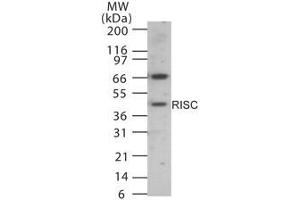 Image no. 1 for anti-serine Carboxypeptidase 1 (SCPEP1) (AA 28-43) antibody (ABIN233212) (SCPEP1 anticorps  (AA 28-43))