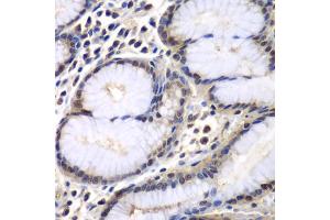 Immunohistochemistry of paraffin-embedded human colon using PSMB2 antibody (ABIN6291444) at dilution of 1:100 (40x lens).