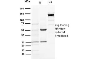 SDS-PAGE Analysis Purified DOG-1 Mouse Monoclonal Antibody (DG1/1484).