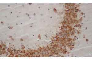 Immunohistochemistry of paraffin-embedded Mouse brain using WNT1 Polyclonal Antibody at dilution of 1:50 (WNT1 anticorps)