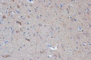 Immunohistochemistry of paraffin-embedded rat brain using Raptor Rabbit mAb (ABIN7269900) at dilution of 1:100 (40x lens).